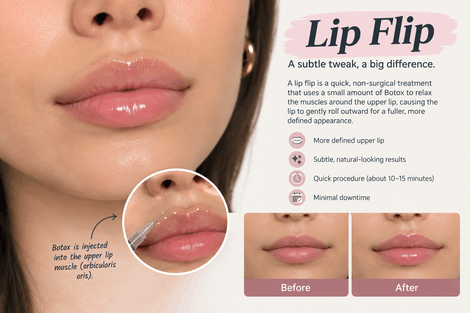 Lip Flip